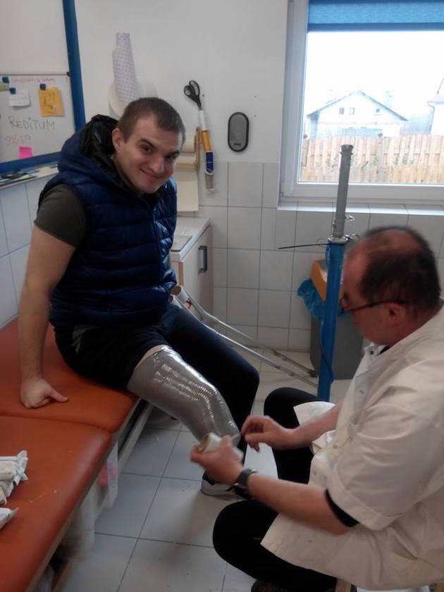 Leszek Kloszewski fits Ukrainian volunteer soldier Maksym Klokun with a prosthetic device at his home in Poland.