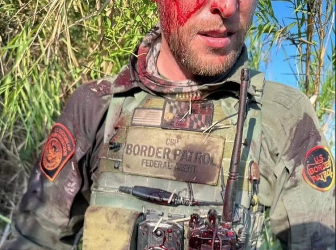 Border Agent Bloodied After Alleged Fight With Migrant